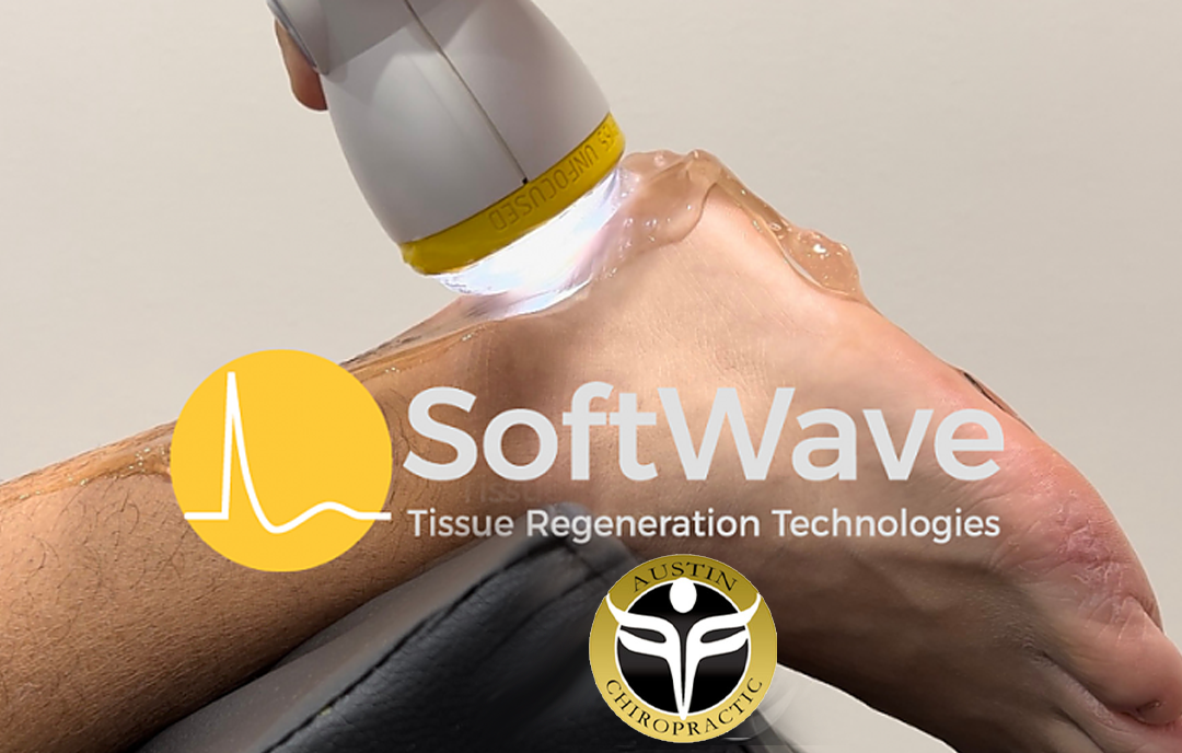 Why SoftWave Therapy Could Be Your Solution for Plantar Fasciitis!